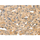 Immunohistochemistry - UCP1 Antibody from Signalway Antibody (43429) - Antibodies.com