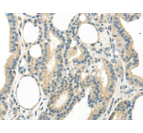 Immunohistochemistry - WNT6 Antibody from Signalway Antibody (43435) - Antibodies.com