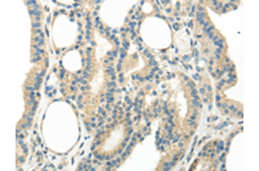 Immunohistochemistry - WNT6 Antibody from Signalway Antibody (43435) - Antibodies.com