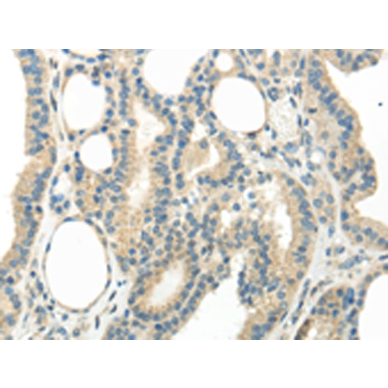 Immunohistochemistry - WNT6 Antibody from Signalway Antibody (43435) - Antibodies.com
