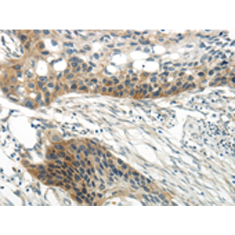 Immunohistochemistry - WNT6 Antibody from Signalway Antibody (43435) - Antibodies.com