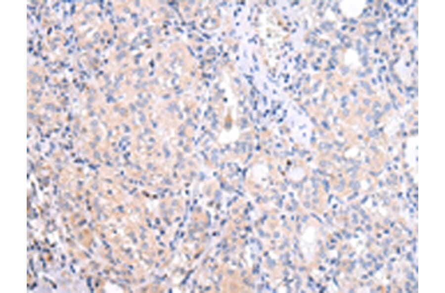 Immunohistochemistry - ATF6 Antibody from Signalway Antibody (43444) - Antibodies.com