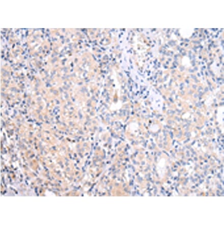 Immunohistochemistry - ATF6 Antibody from Signalway Antibody (43444) - Antibodies.com