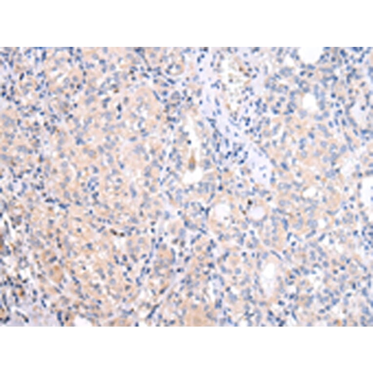 Immunohistochemistry - ATF6 Antibody from Signalway Antibody (43444) - Antibodies.com