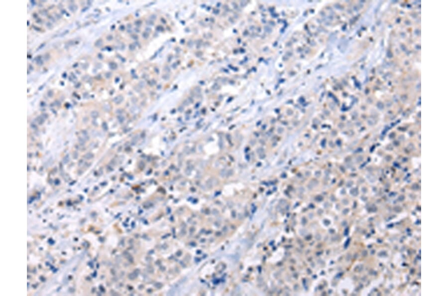 Immunohistochemistry - ATF6 Antibody from Signalway Antibody (43444) - Antibodies.com