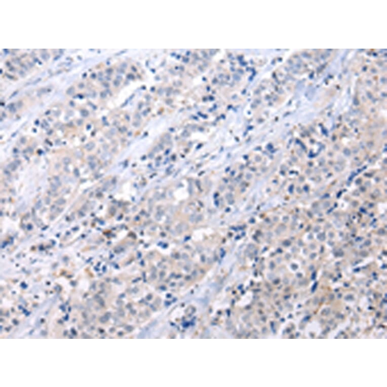Immunohistochemistry - ATF6 Antibody from Signalway Antibody (43444) - Antibodies.com