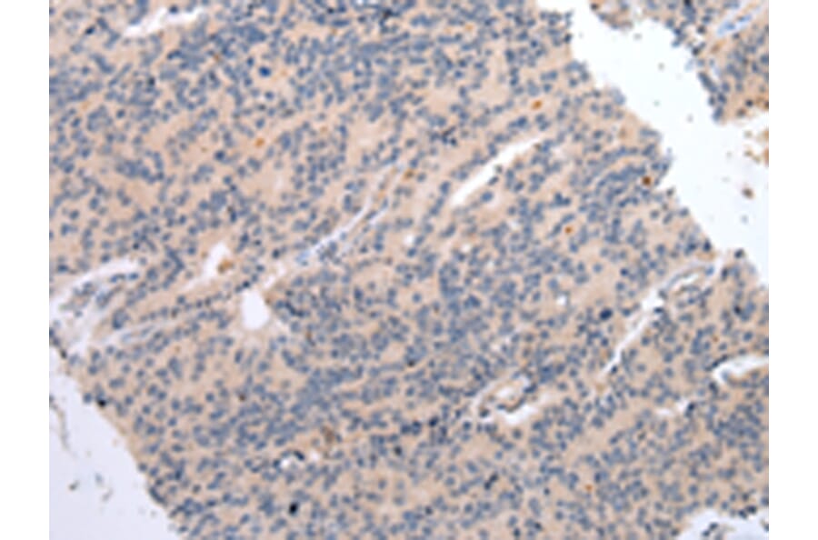 Immunohistochemistry - DVL3 Antibody from Signalway Antibody (43454) - Antibodies.com