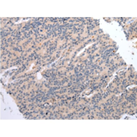 Immunohistochemistry - DVL3 Antibody from Signalway Antibody (43454) - Antibodies.com