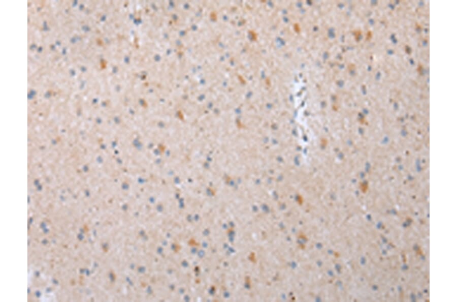 Immunohistochemistry - DVL3 Antibody from Signalway Antibody (43454) - Antibodies.com