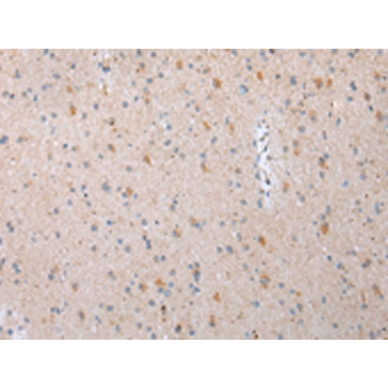 Immunohistochemistry - DVL3 Antibody from Signalway Antibody (43454) - Antibodies.com