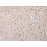 Immunohistochemistry - DVL3 Antibody from Signalway Antibody (43454) - Antibodies.com