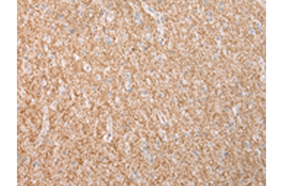 Immunohistochemistry - DYSF Antibody from Signalway Antibody (43455) - Antibodies.com