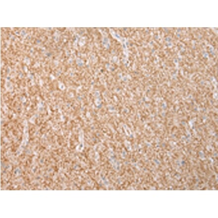 Immunohistochemistry - DYSF Antibody from Signalway Antibody (43455) - Antibodies.com