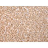Immunohistochemistry - DYSF Antibody from Signalway Antibody (43455) - Antibodies.com