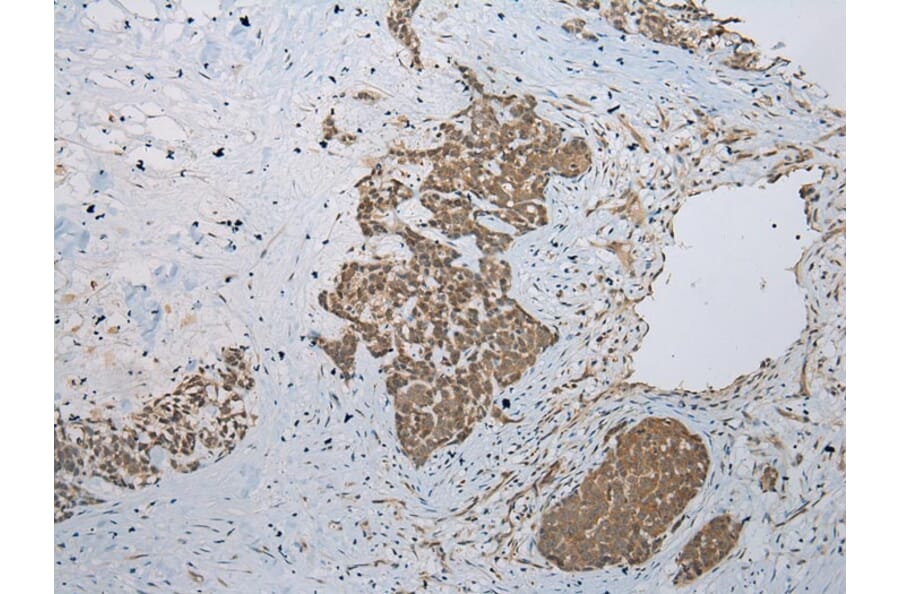 Immunohistochemistry - GLI2 Antibody from Signalway Antibody (43461) - Antibodies.com
