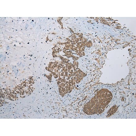 Immunohistochemistry - GLI2 Antibody from Signalway Antibody (43461) - Antibodies.com