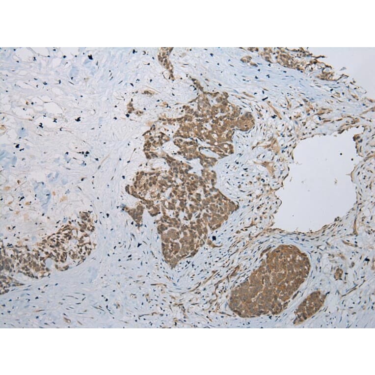 Immunohistochemistry - GLI2 Antibody from Signalway Antibody (43461) - Antibodies.com