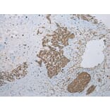 Immunohistochemistry - GLI2 Antibody from Signalway Antibody (43461) - Antibodies.com