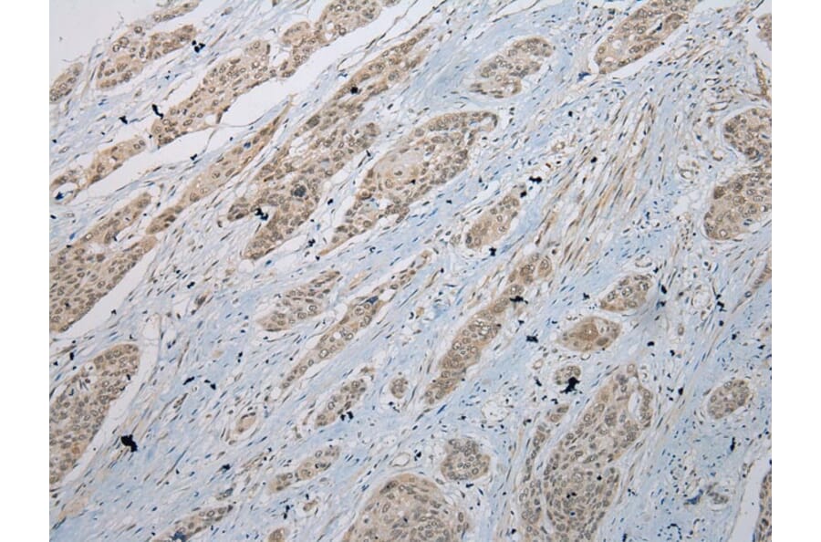 Immunohistochemistry - GLI2 Antibody from Signalway Antibody (43461) - Antibodies.com