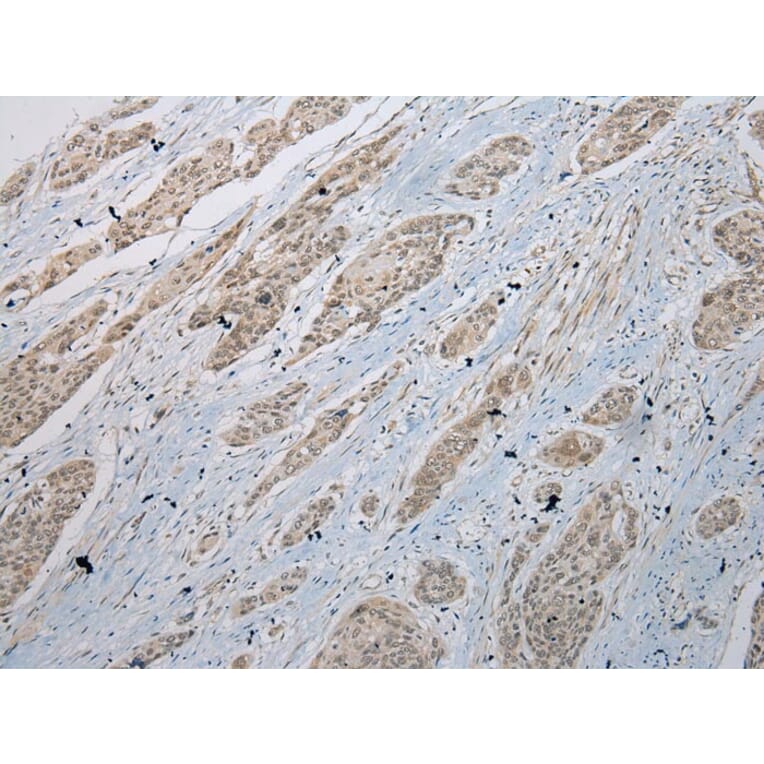 Immunohistochemistry - GLI2 Antibody from Signalway Antibody (43461) - Antibodies.com