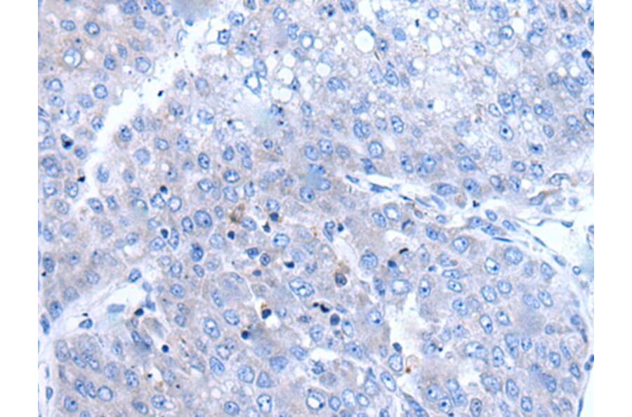 BTG4 Antibody from Signalway Antibody (43501) - Antibodies.com