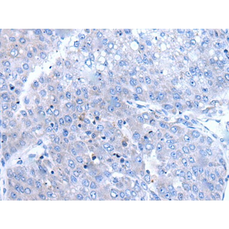 BTG4 Antibody from Signalway Antibody (43501) - Antibodies.com