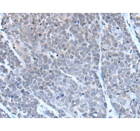 GJA5 Antibody from Signalway Antibody (43503) - Antibodies.com