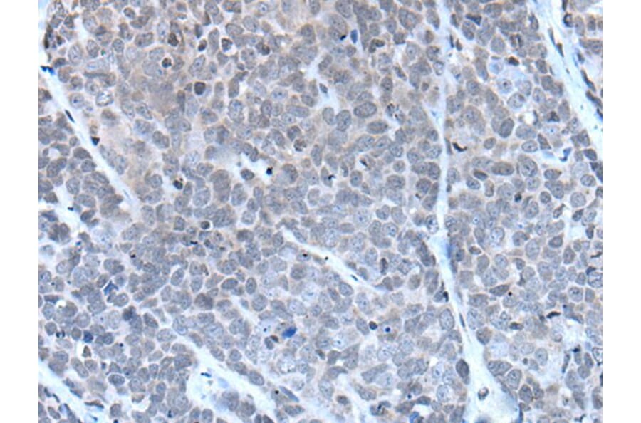 GJA5 Antibody from Signalway Antibody (43503) - Antibodies.com