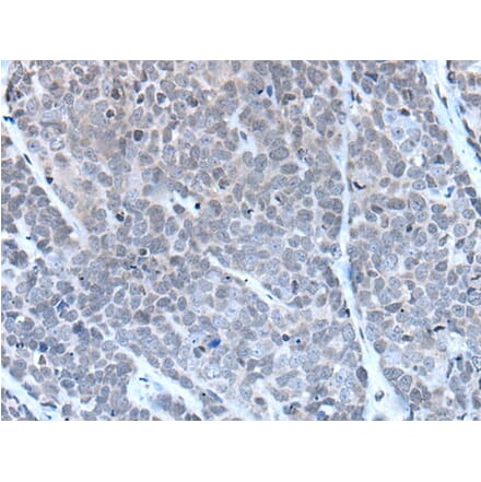 GJA5 Antibody from Signalway Antibody (43503) - Antibodies.com