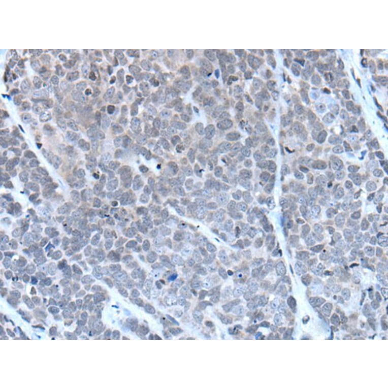 GJA5 Antibody from Signalway Antibody (43503) - Antibodies.com