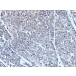 GJA5 Antibody from Signalway Antibody (43503) - Antibodies.com