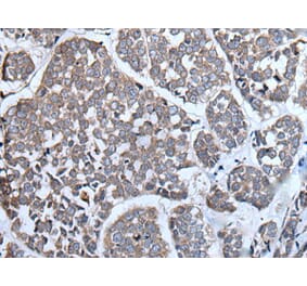 CYGB Antibody from Signalway Antibody (43504) - Antibodies.com