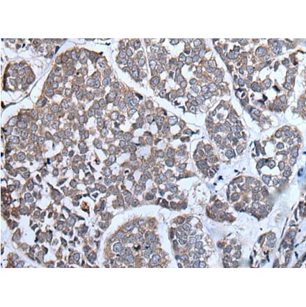CYGB Antibody from Signalway Antibody (43504) - Antibodies.com