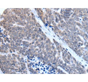 TBX6 Antibody from Signalway Antibody (43507) - Antibodies.com