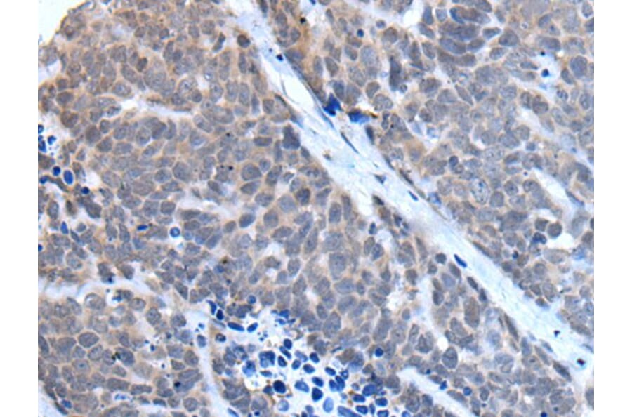 TBX6 Antibody from Signalway Antibody (43507) - Antibodies.com