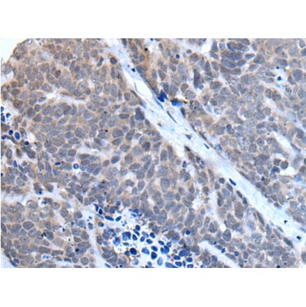 TBX6 Antibody from Signalway Antibody (43507) - Antibodies.com