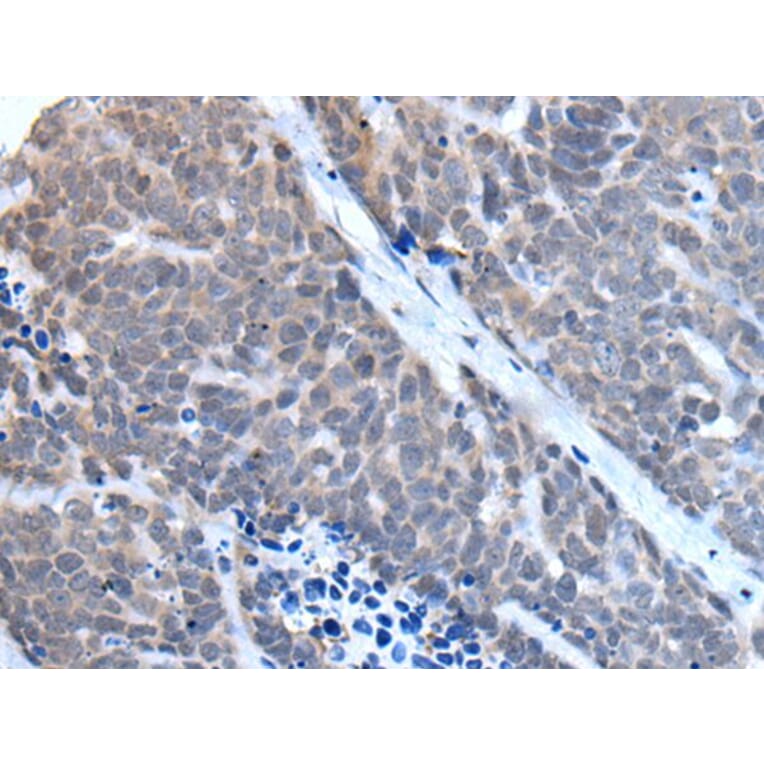 TBX6 Antibody from Signalway Antibody (43507) - Antibodies.com