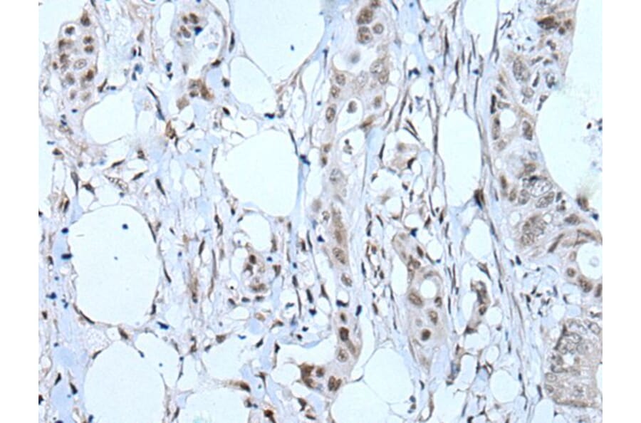 TBX6 Antibody from Signalway Antibody (43507) - Antibodies.com