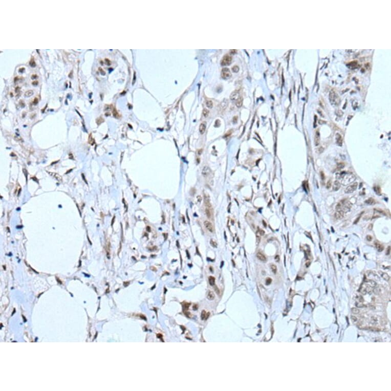 TBX6 Antibody from Signalway Antibody (43507) - Antibodies.com
