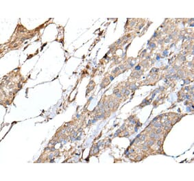 IL20 Antibody from Signalway Antibody (43508) - Antibodies.com