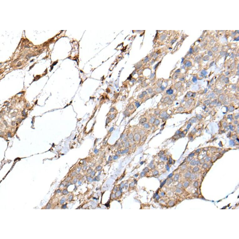 IL20 Antibody from Signalway Antibody (43508) - Antibodies.com