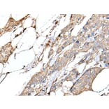 IL20 Antibody from Signalway Antibody (43508) - Antibodies.com
