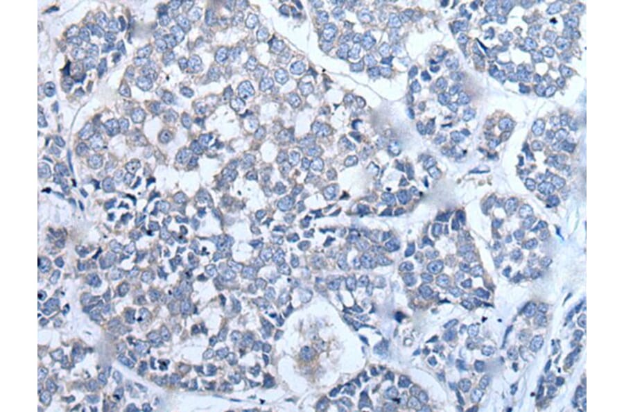 LCAT Antibody from Signalway Antibody (43511) - Antibodies.com