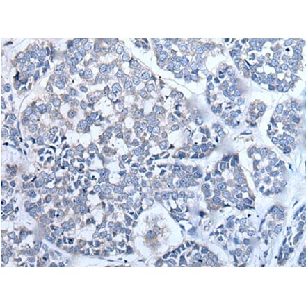 LCAT Antibody from Signalway Antibody (43511) - Antibodies.com