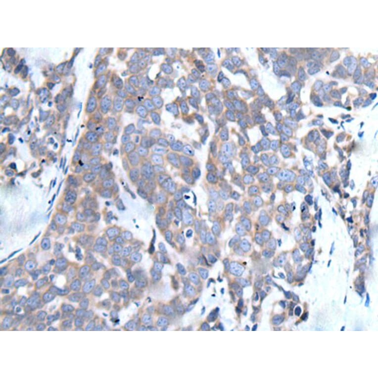 LCAT Antibody from Signalway Antibody (43511) - Antibodies.com