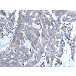 LCAT Antibody from Signalway Antibody (43511) - Antibodies.com