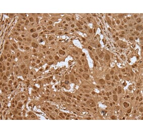 ELF1 Antibody from Signalway Antibody (43514) - Antibodies.com