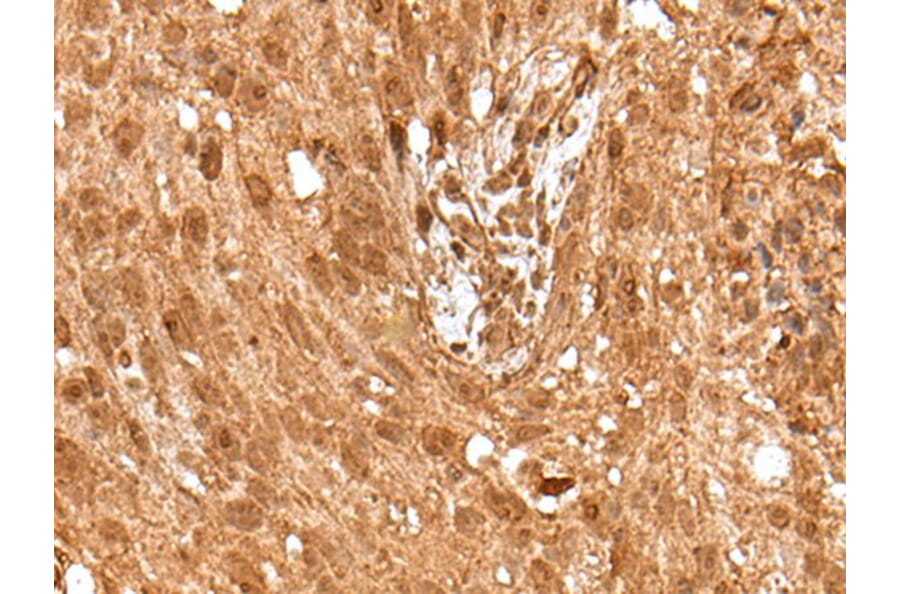 ELF1 Antibody from Signalway Antibody (43514) - Antibodies.com
