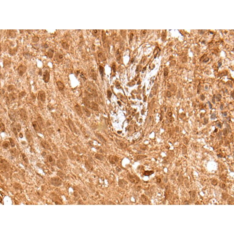 ELF1 Antibody from Signalway Antibody (43514) - Antibodies.com