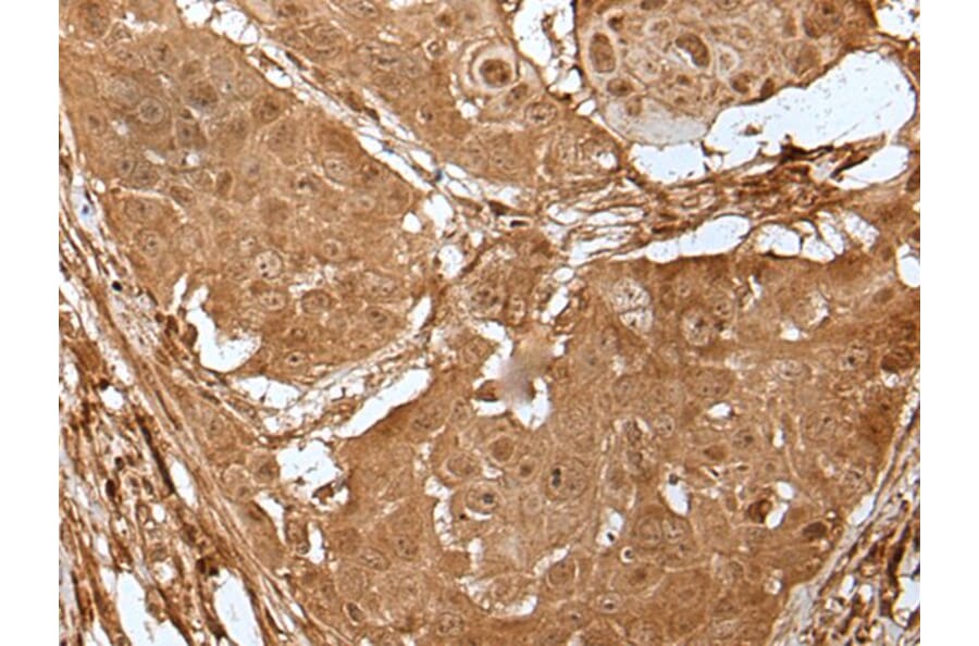 LIPG Antibody from Signalway Antibody (43517) - Antibodies.com